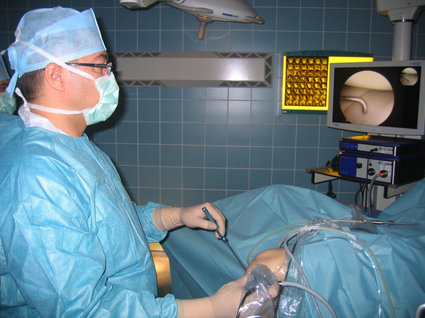 операция артроскопия коленного сустава в Москве